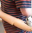 Image result for Robotic Arm Human Prosthetic