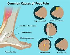 Image result for feet pain cause