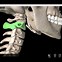 Image result for Cervical Spine C5 C6 C7