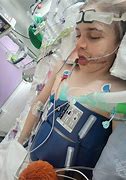 Image result for Boy On Life Support for Life