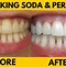 Image result for Best Way to Whiten Your Teeth
