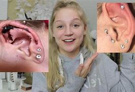 Image result for Examples of Piercings Gone Wrong