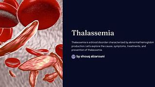 Image result for Thalassemia Autosomal Recessive