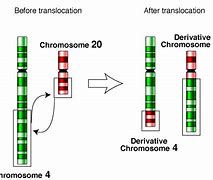 Image result for Chromosome Translocation