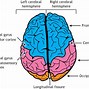 Image result for Brain without Hemispheres
