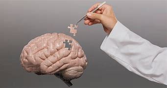 Image result for Shrinking Brain Disease