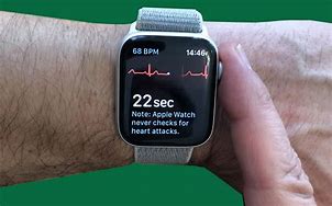 Image result for Apple Watch ECG Electrode