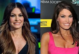 Image result for Kimberly Guilfoyle Before and After