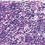 Image result for Lung Cancer Cells