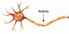 Image result for axonio