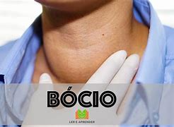 Image result for bocio