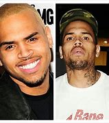 Image result for Chris Brown Plastic Surgery