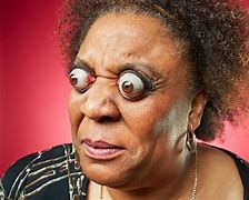 Image result for Biggest Eyes in the World