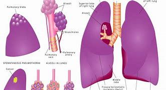Image result for Marijuanna Smokers Lungs
