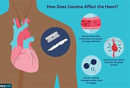 Image result for Cocaine Excipients