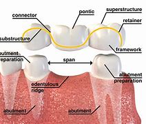 Image result for Tooth Crown Anatomy