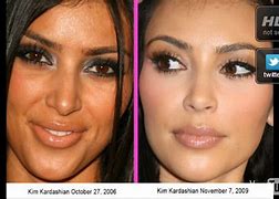 Image result for Kim Kardashian Eye Bags