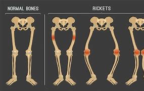 Image result for Rickets Disease in Dogs Pictures/Images