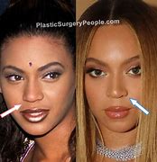 Image result for Beyoncé Before Nose Job