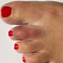 Image result for Broken Toe Bruising