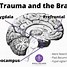 Image result for Parts of Trauama Brain