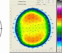 Image result for Corneal Curvature