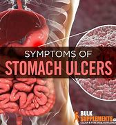 Image result for Stomach Ulcer Pain