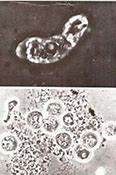 Image result for amoeba 阿米巴原虫