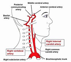 Image result for Vertebral Artery Blood Supply