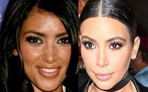 Image result for Kim Kardashian Skin Lightening