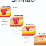 Image result for Severe Wounds