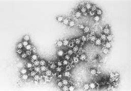 Image result for CoxsackieVirus