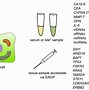 Image result for Rachischisis Alpha Feto Protein Level