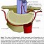 Image result for Radicular Artery La Gi