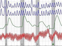 Image result for Polygraph Block Diagram