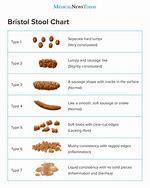 Image result for Types of Stools Bowel Movements