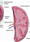 Image result for Accessory Spleen