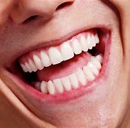 Image result for Smile Teeth