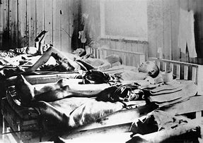 Image result for Atomic Bomb Casualties