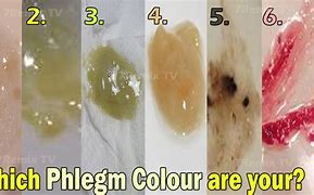 Image result for Phlegm Color Guide