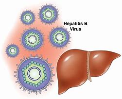 Image result for Hepatitis B