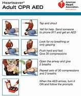 Image result for CPR Stop AHA