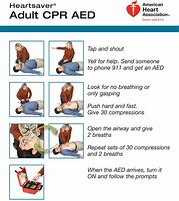 Image result for CPR/AED Card 30 Compressions with 2 Breaths