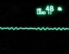 Image result for Heart Monitor Bracelet