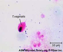 Image result for Trichomoniasis Parasite