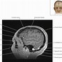 Image result for Brain 34 View