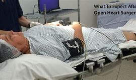 Image result for Recovery From Open Heart Surgery
