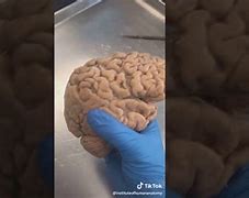 Image result for What Does a Real Human Brain Look Like