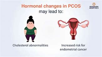 Image result for Polycystic Ovary Syndrome