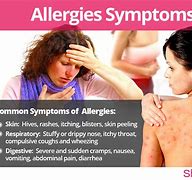 Image result for Mild Allergic Reaction Symptoms
